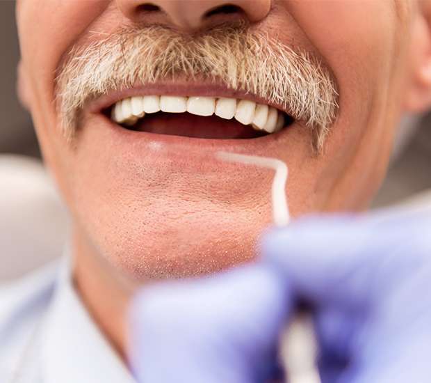 Spring Adjusting to New Dentures