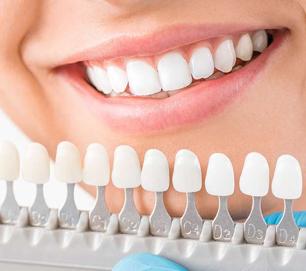 Spring Cosmetic Dentist
