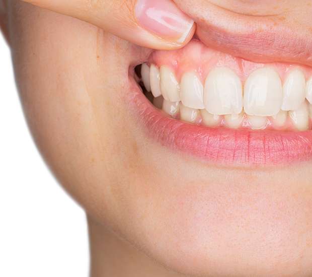 Spring Gum Disease