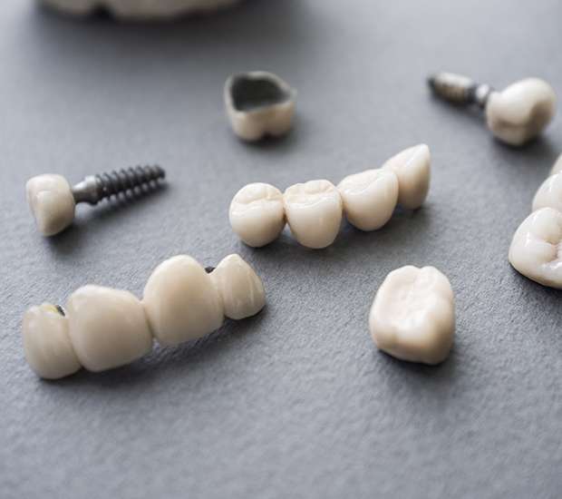 Spring The Difference Between Dental Implants and Mini Dental Implants