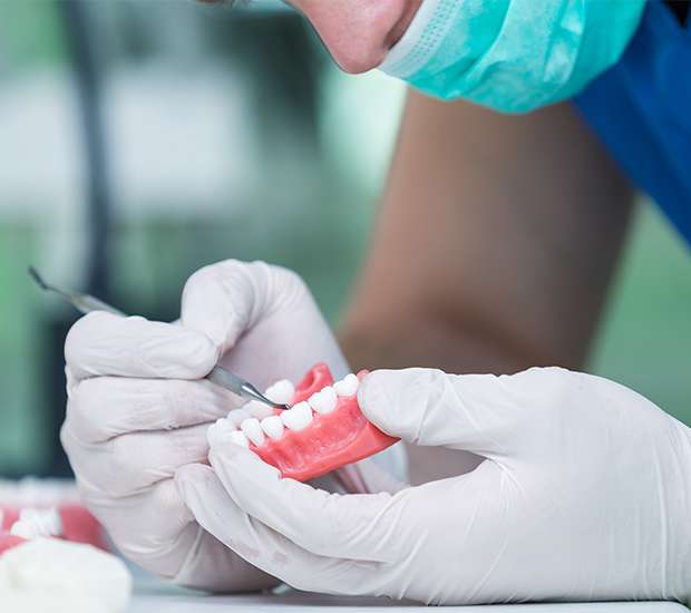 Spring Partial Denture for One Missing Tooth