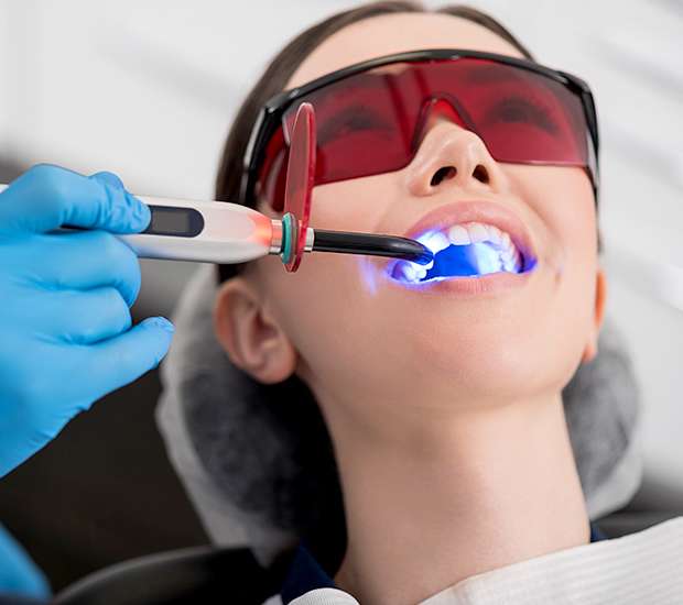 Spring Professional Teeth Whitening